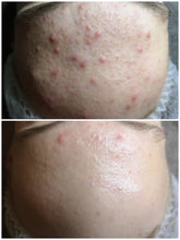 Load image into Gallery viewer, Optiphi Classic Barrier Repair - 50ml