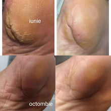 Load image into Gallery viewer, Callux Pro Home Dry Pedicure Kit