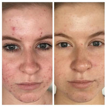 Load image into Gallery viewer, Before & After Photo's