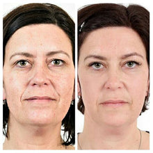 Load image into Gallery viewer, Optiphi Dermintense Active Gel - 30ml