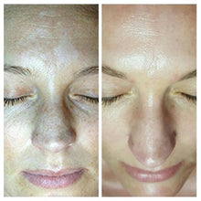 Load image into Gallery viewer, Optiphi Moisture Control Light