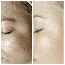 Load image into Gallery viewer, Before & After Photo's