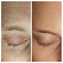 Load image into Gallery viewer, Before & After Photo's