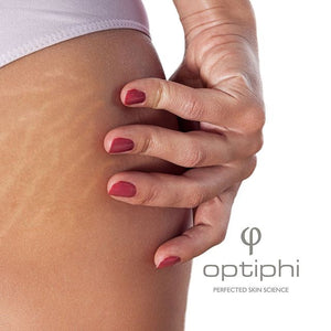 Optiphi Body Curve Scar Therapy - 100ml